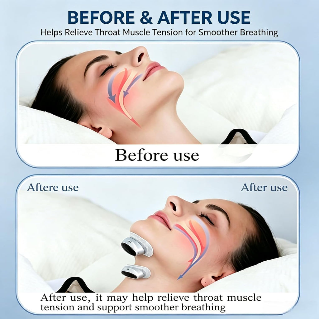 Smart Anti-Snoring Device – Non-Invasive Design for Better Sleep